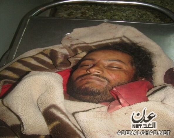 مقتل مواطن في لحج أثناء نومه في منزله