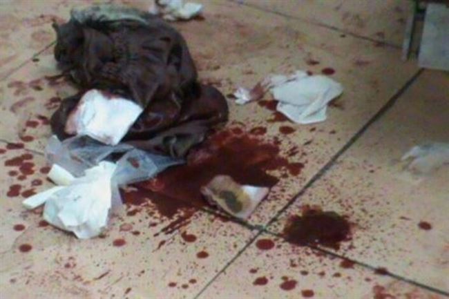 اليمن: قتلى وجرحى بإنفجار قنبلة يدوية في سوق شعبي