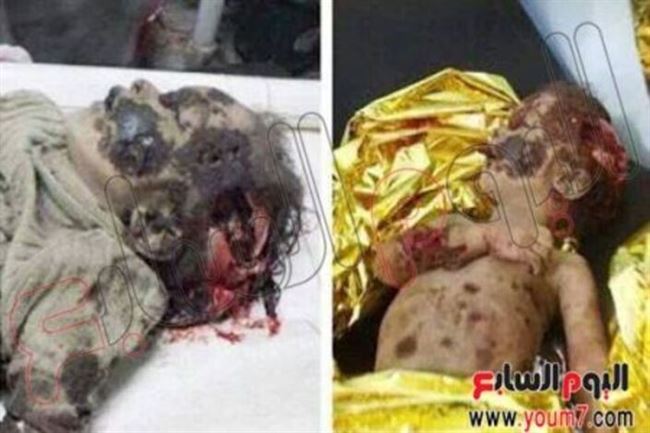 ناشطون يمنيون لـ(اليوم السابع) المصرية:الإخوان وتنظيم القاعدة يرتكبون مجازر ضد أبناء جنوب اليمن بتمويل قطرى