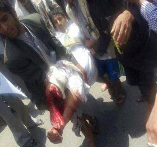 ذكرت مقتل ما لا يقل عن 9 أشخاص وجرح 67 آخرين.. هيومن رايتس ووتش: اليمن استخدام القوة المميتة ضدّ متظاهرين حوثيين