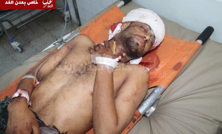 مصدر طبي : اصابة شاب بعيار ناري اطلقه جنود موالون للحوثي بعدن