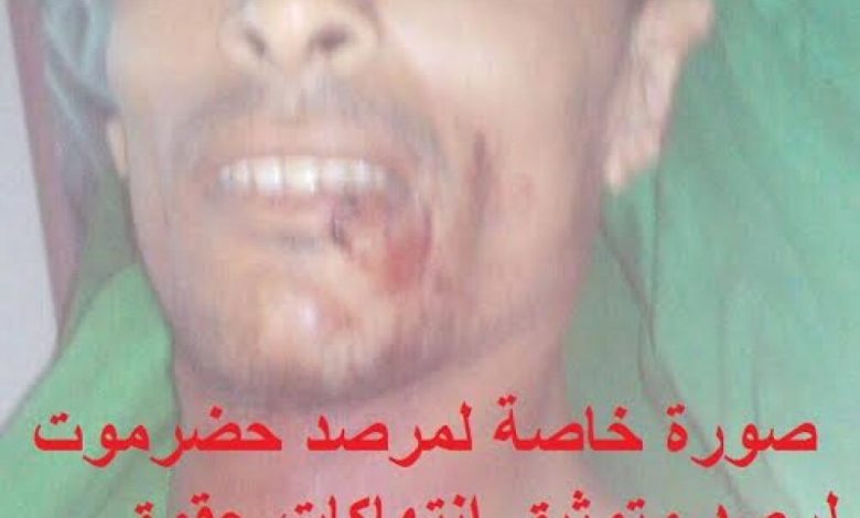 استمراراً لمسلسل دراجة الموت .. اغتيال شاب بمدينة القطن بحضرموت
