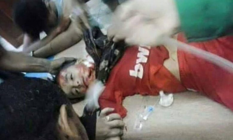 مقتل طفل وإصابة شاب برصاص قناصة صالح والحوثيين بعقبة كريتر