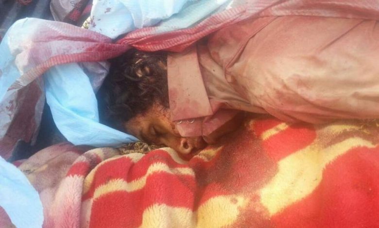 مقتل 3 من عناصر القاعدة برصاص نقطة للمقاومة الجنوبية بأحور
