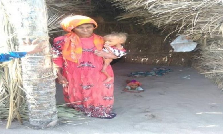 اليمن: الجوع ينال من أطفال قرية البقعة بالحديدة