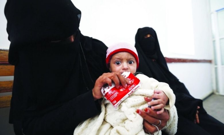 مقتل 1400 طفل يمني بفعل الانقلاب على الشرعية