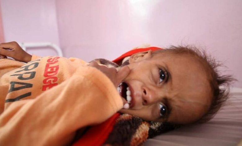 أوكسفام: 7 ملايين يمني يعانون من المجاعة