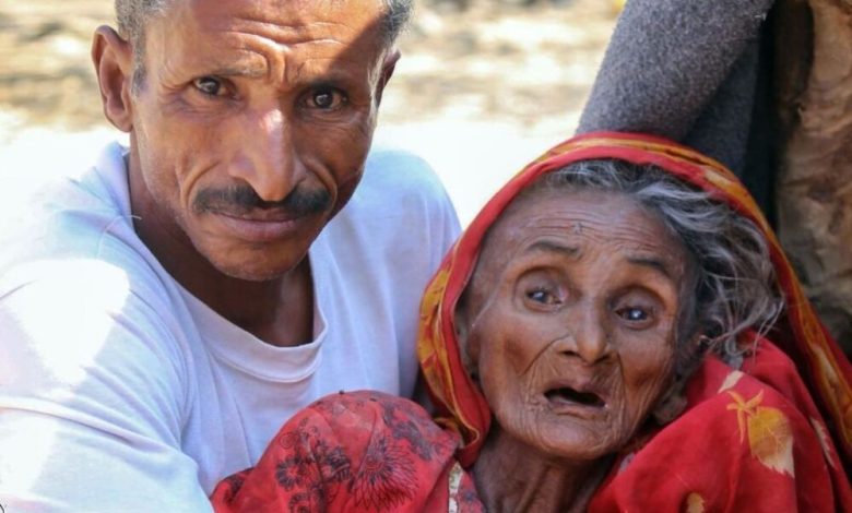منظمات دولية: اليمن على أعتاب المجاعة