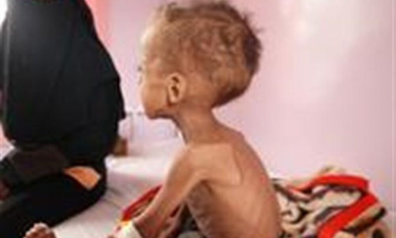 الأمم المتحدة:اليمن على حافة الوقوع في مجاعة شديدة