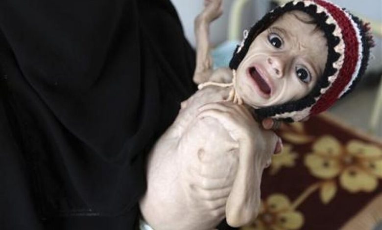 اليونيسف: وفاة أكثر من 4 ألف أم و23 الف طفل حديث الولادة خلال 2016 في اليمن