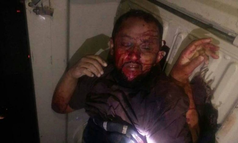 مقتل قيادي بارز في تنظيم القاعدة أثناء اشتباك مع نقطة أمنية في مديرية الوضيع بأبين