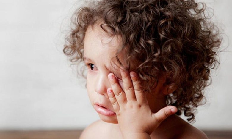 كيف نتعامل مع احمرار العين عند الأطفال؟