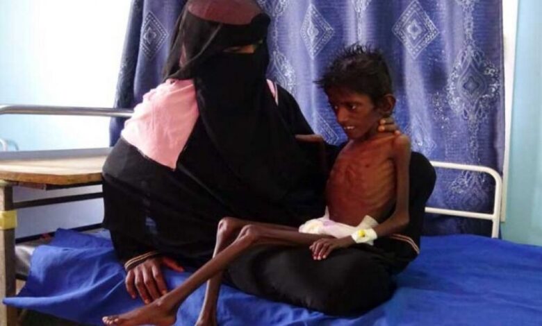 حرب اليمن.. المجاعة تتأهب لالتهام الفقراء