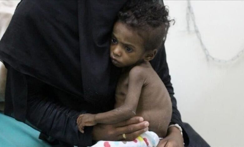 “الأمم المتحدة” تعلن وفاة 773 بالكوليرا في اليمن منذ بداية العام الجاري