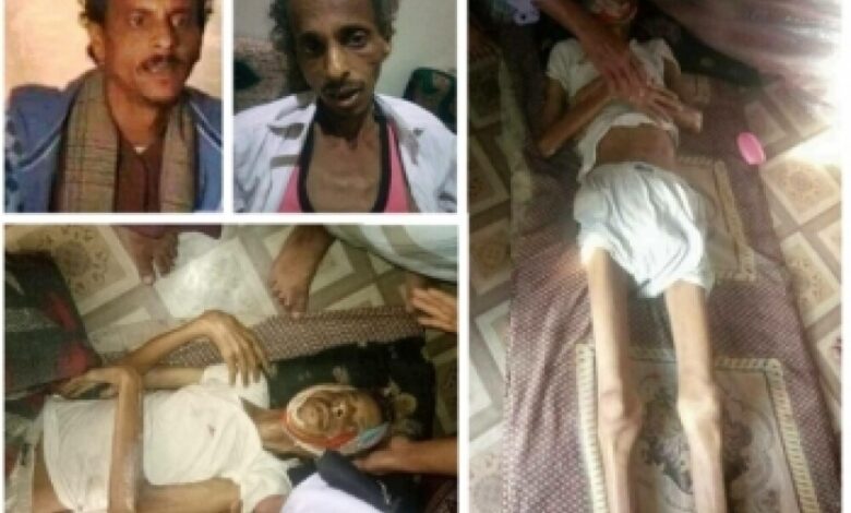 التحالف اليمني لرصد انتهاكات حقوق الإنسان يرصد 455 حالة تعذيب في سجون الحوثي