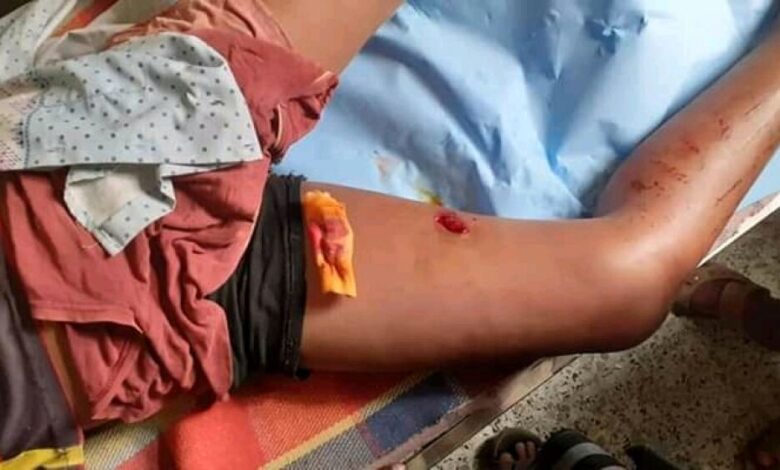 إصابة طفل بجروح خطيرة جراء تعرضه لطلقة قناص حوثي في عيريم لحج