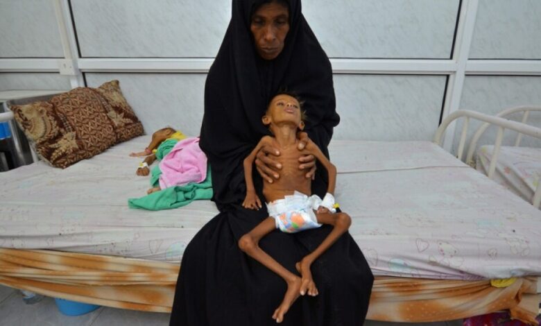 منظمة الصحة العالمية تصدر تقريراً صادماً عن وفيات وباء الكوليرا في اليمن