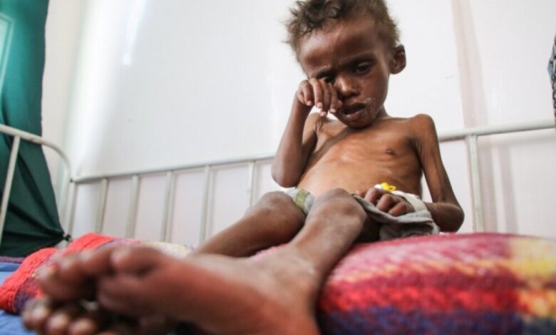 أزمة اليمن الغذائية.. كيف نهش الحوثيون في بطون المدنيين؟