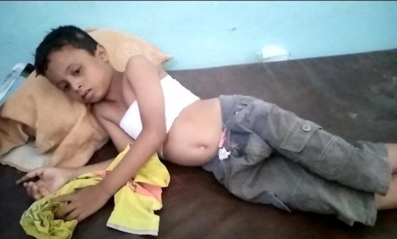 إصابة طفل بجروح في حيس جراء استهداف المليشيات الحوثية للمدينة
