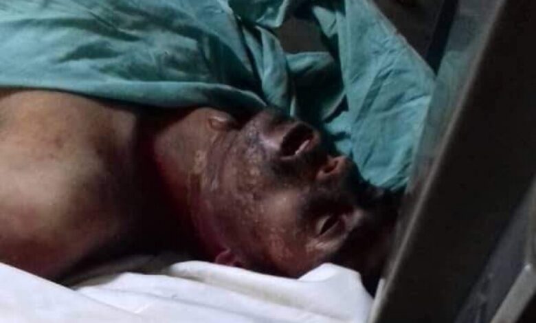 مقتل مواطن تحت التعذيب في سجون مليشيا الحوثي بعد أشهر من اختطافه وإخفائه مع 7 من أفراد أسرته