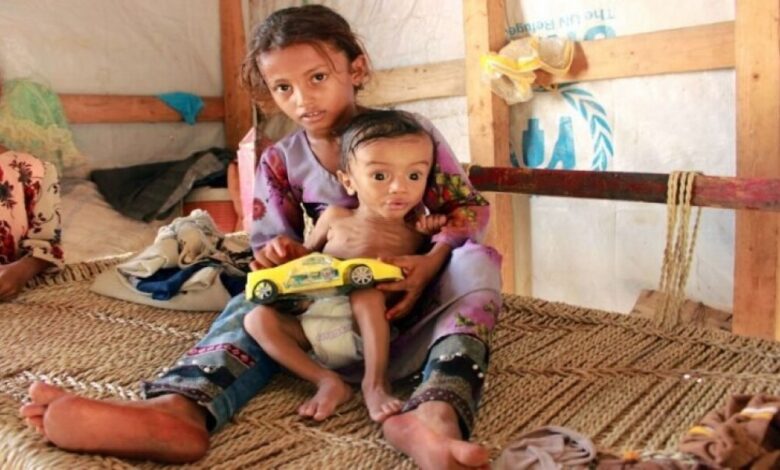 الأمم المتحدة: سوء تغذية الأطفال يرتفع لمستويات جديدة في أجزاء من اليمن