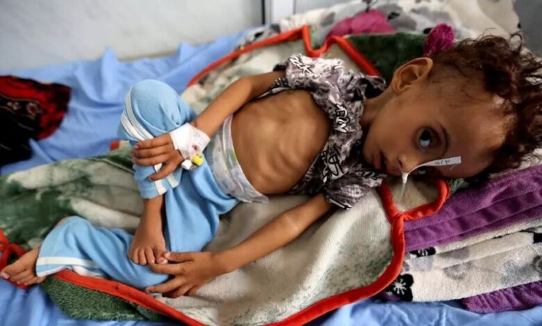 منظمة دولية: أطفال اليمن يدفعون الثمن النهائي للحرب