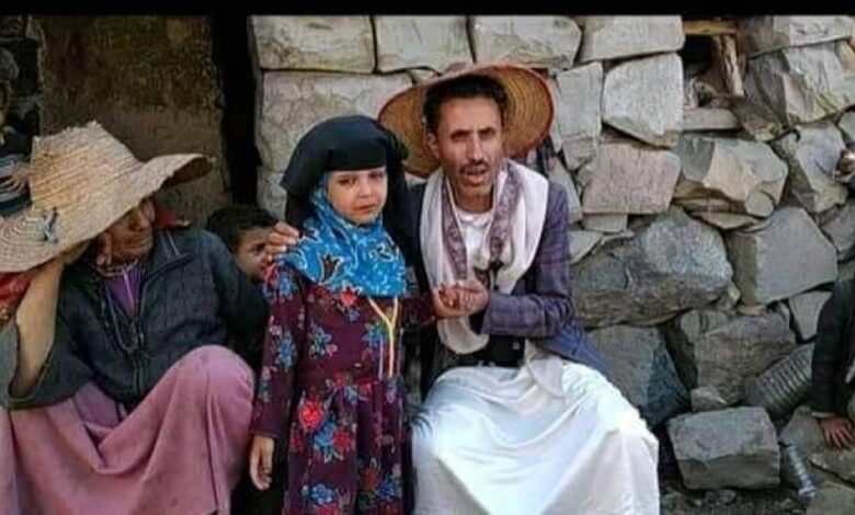 صدمة في اليمن عقب بيع اب لابنته بسبب الفقر والحاجة